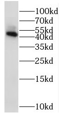 STK32B antibody|STK32B抗体