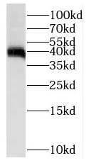 PTPN7 antibody|PTPN7抗体