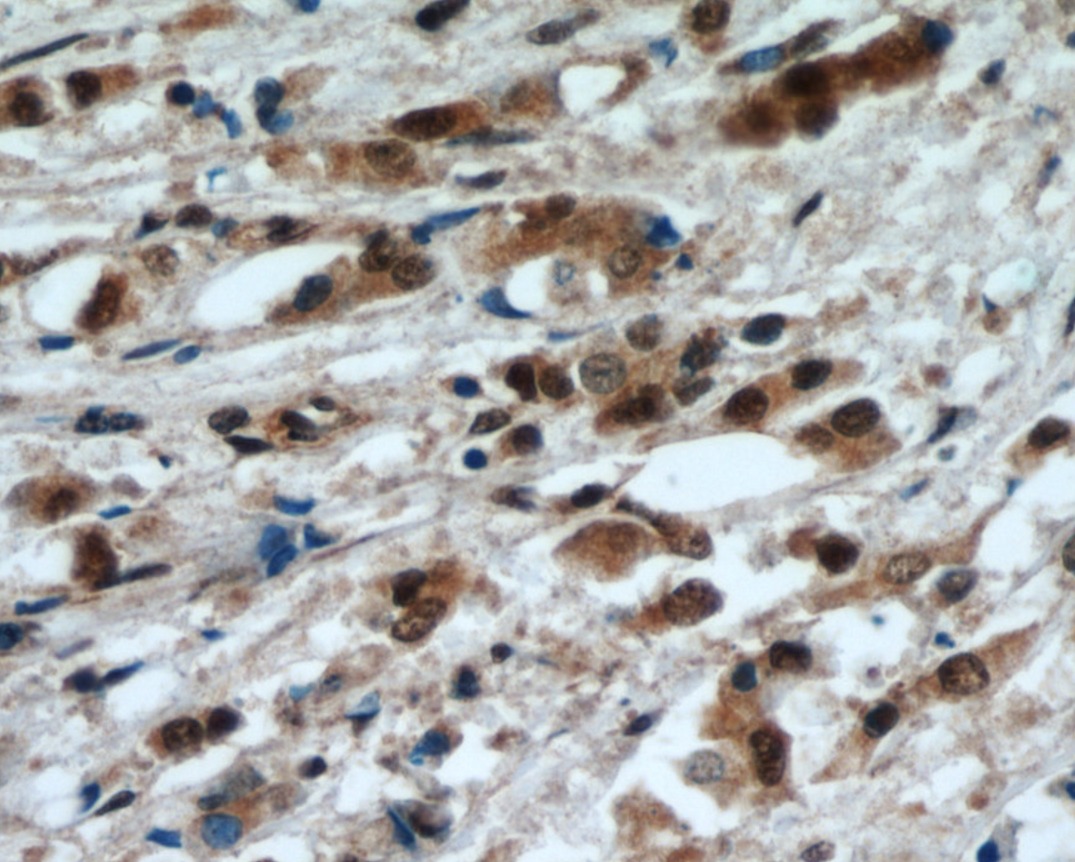 MYC antibody|MYC抗体 FNab01791