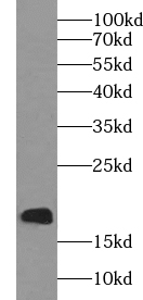 UBE2I antibody|UBE2I抗体 FNab091