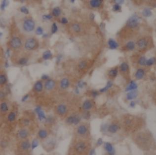 SAA1 antibody|SAA1抗体