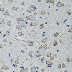 IL1A antibody|IL1A抗体