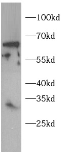 TWIST1 antibody|TWIST1抗体 FNab1