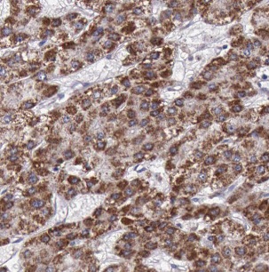 B4GALT3 antibody|B4GALT3抗体