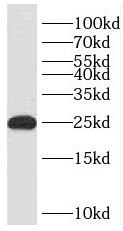 PHLDA2 antibody|PHLDA2抗体