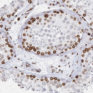 LRRTM1 antibody|LRRTM1抗体