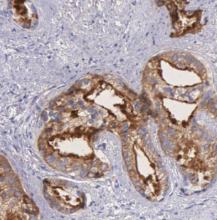 LSM1 antibody|LSM1抗体