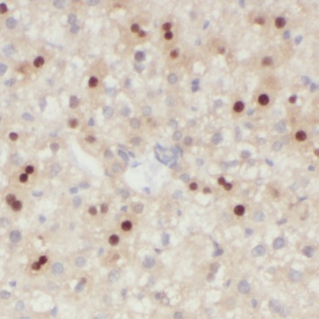 NMRAL1 antibody|NMRAL1抗体