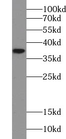 TRNAU1AP antibody|TRNAU1AP抗体