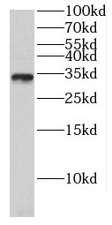 CIBAR1 antibody|CIBAR1抗体