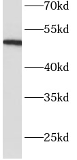 SERPINC1 antibody|SERPINC1抗体 F