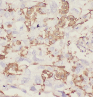 IL22RA2 antibody|IL22RA2抗体 FNa