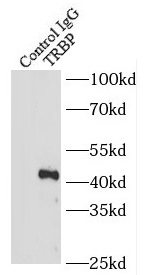 TFE3 antibody|TFE3抗体