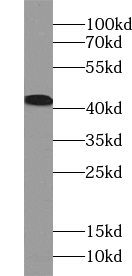 UROD antibody|UROD抗体