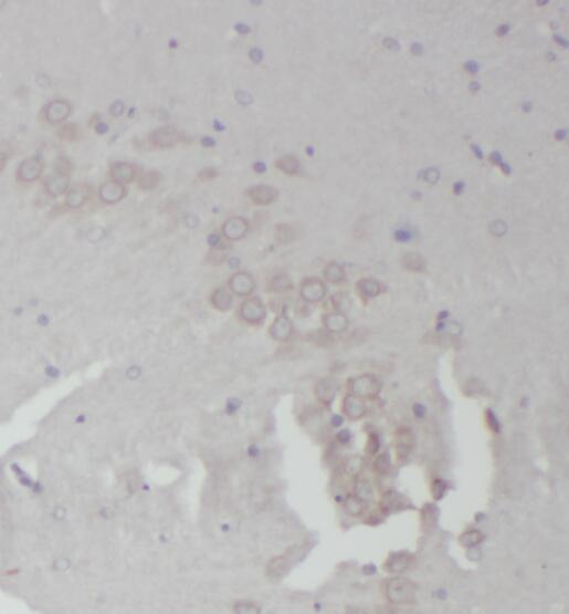 RPL18A antibody|RPL18A抗体 FNab0