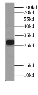 LORICRIN antibody|LORICRIN抗体