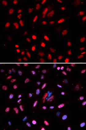 POLD1 antibody|POLD1抗体