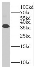 TNNT3 antibody|TNNT3抗体