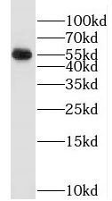 SMARCD3 antibody|SMARCD3抗体