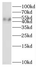 NOB1 antibody|NOB1抗体 FNab05777