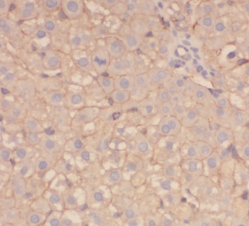 AGT antibody|AGT抗体 FNab00394