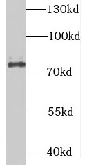 SUPV3L1 antibody|SUPV3L1抗体