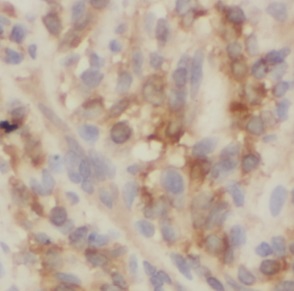 UBE2H antibody|UBE2H抗体