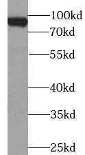 BACH1 antibody|BACH1抗体