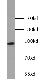 ZNF606 antibody|ZNF606抗体