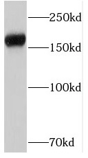 PTPRZ1 antibody|PTPRZ1抗体