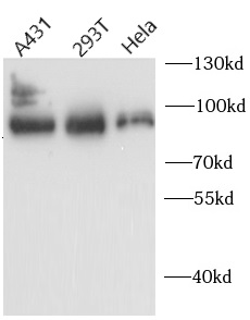 AFM antibody|AFM抗体 FNab00199