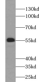 UGT2B4 antibody|UGT2B4抗体