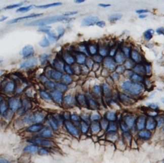 SLC1A5 antibody|SLC1A5抗体