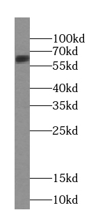 UNC5D-Specific antibody|UNC5D抗