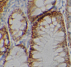 PDGFA antibody|PDGFA抗体
