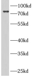 ARMC8 antibody|ARMC8抗体