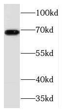 TCF7L2 antibody|TCF7L2抗体