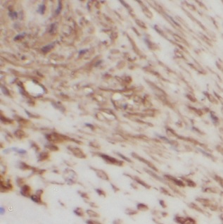 IGFBP1 antibody|IGFBP1抗体