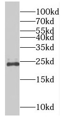RAB9B antibody|RAB9B抗体