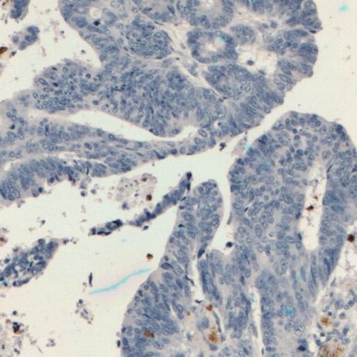 TESC antibody|TESC抗体