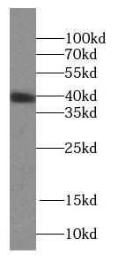 KLK11 antibody|KLK11抗体