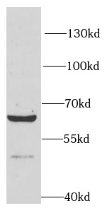 RPN1 antibody|RPN1抗体