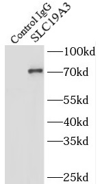 SALL4 antibody|SALL4抗体 FNab075