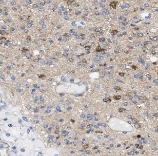 DNM3 antibody|DNM3抗体