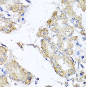 MICA antibody|MICA抗体 FNab05176