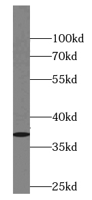 ANXA8 antibody|ANXA8抗体
