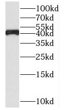 SUDS3 antibody|SUDS3抗体