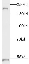 RTN4 antibody|RTN4抗体 FNab07524