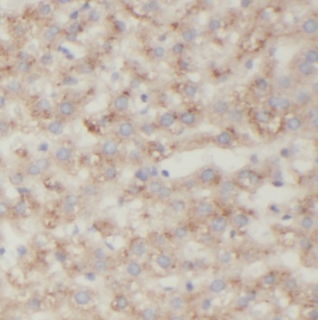 PECR antibody|PECR抗体