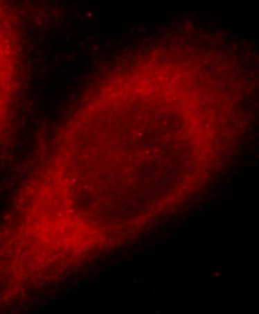 JMY antibody|JMY抗体